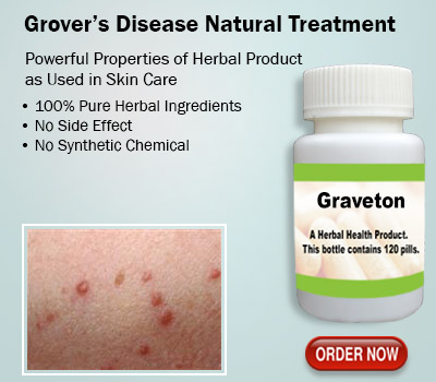 Natural Remedies for Grovers Disease with Herbal Supplement